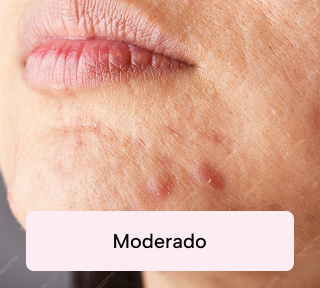 moderado